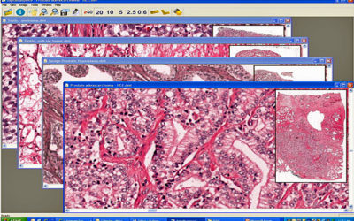 UltraClinics Aims to Spread Telepathology