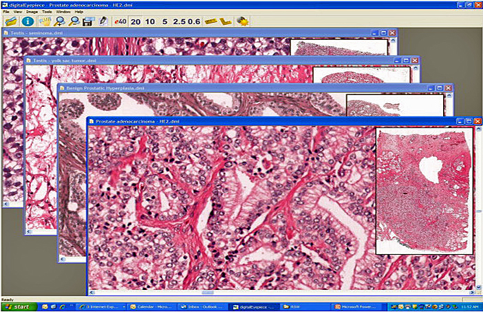 UltraClinics Aims to Spread Telepathology