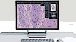 AMA Announces New Add-On Digital Pathology Codes